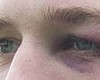 Tease photo